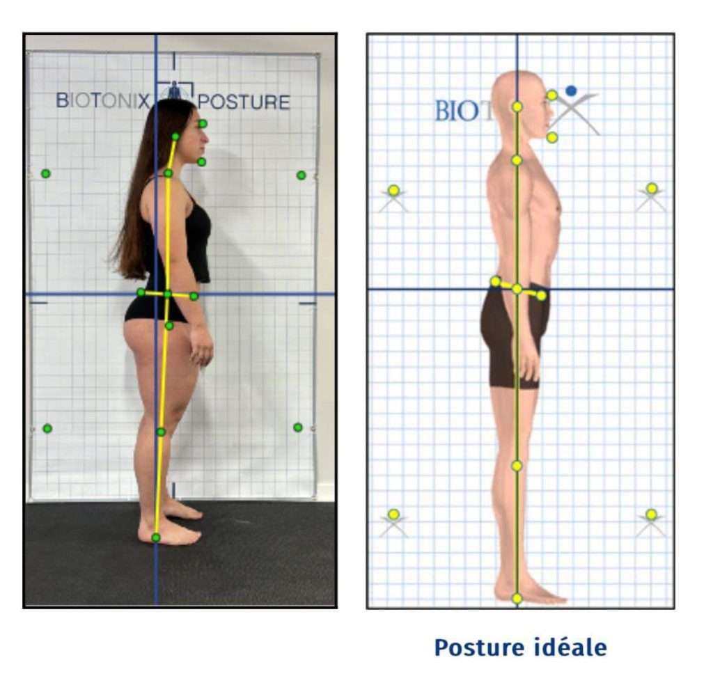 Évaluation de la posture Biotonix : Logiciel #1 pour massothérapeute ...