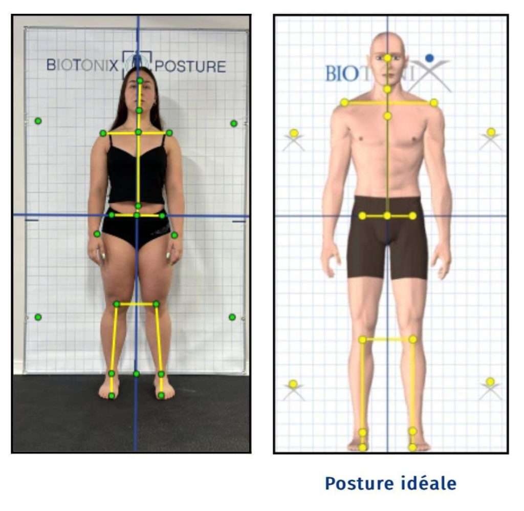 Évaluation de la posture Biotonix : Logiciel #1 pour massothérapeute ...